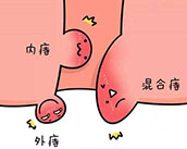 合肥治療痔瘡疾病 合肥肛腸專(zhuān)科醫(yī)院 合肥肛門(mén)醫(yī)院哪家好
