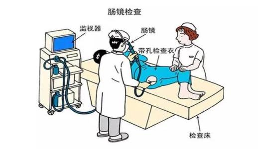 肛門狹窄，治療